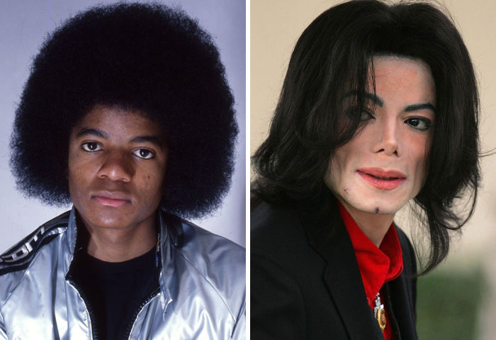 Side-by-side photos showing a celebrity before and after plastic surgery, highlighting dramatic changes in appearance.