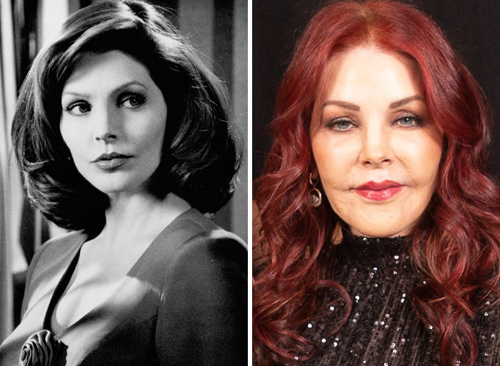 Side-by-side comparison of a female celebrity before and after plastic surgery showcasing dramatic changes in appearance.