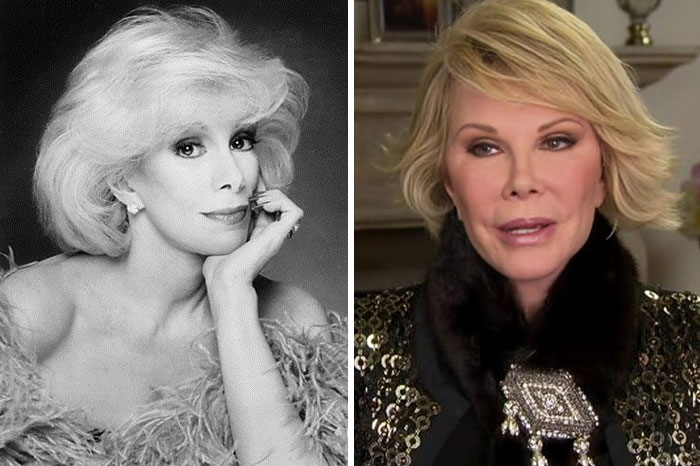 Side-by-side images of a female celebrity before and after plastic surgery showing noticeable facial changes and aging.