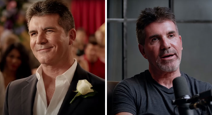 Simon Cowell before and after plastic surgery, showing changes in facial appearance in two side-by-side images.