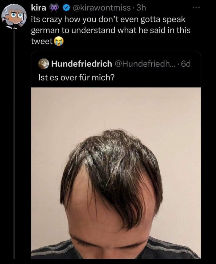 Funny meme featuring a person's receding hairline photo with a humorous tweet in German.
