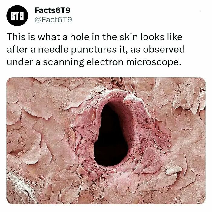 Close-up of skin puncture under a scanning electron microscope, resembling a porous texture.