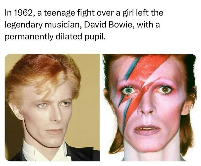 Two images of David Bowie, one with makeup and lightning bolt, showing his permanently dilated pupil.