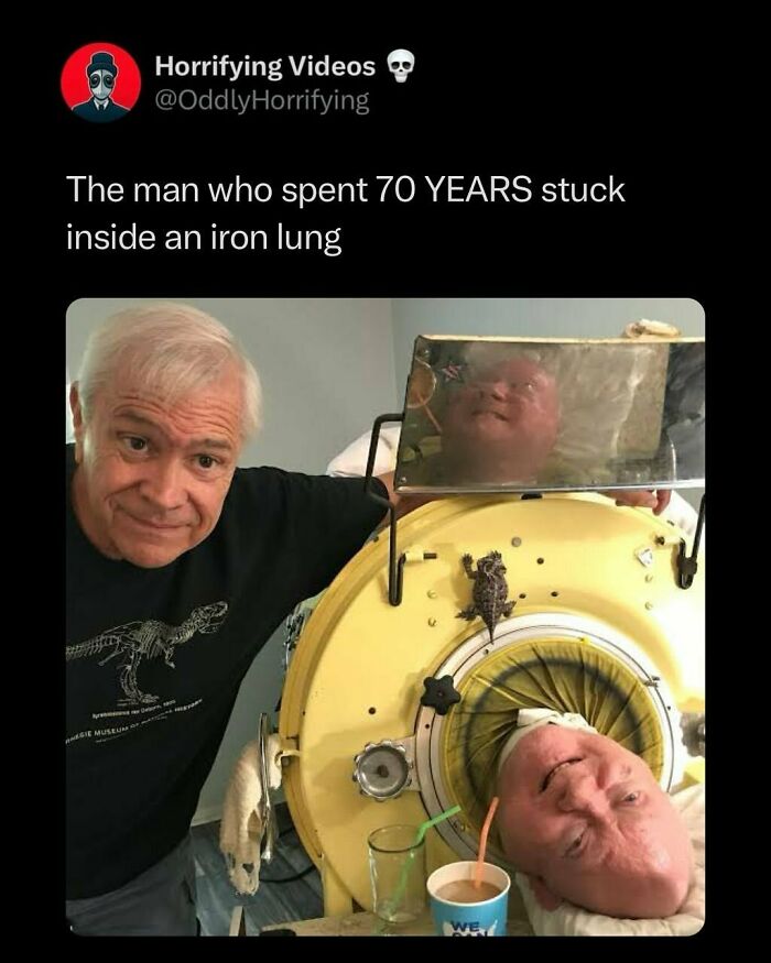 Man beside an iron lung with another man's face visible inside, creating an unnerving scene.