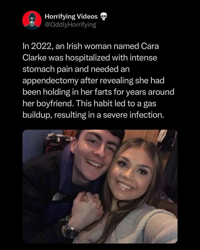 Couple smiling together; unnerving story of hospitalization due to a gas buildup from holding in farts.