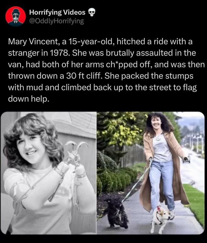 "Oddly horrifying tale of survival: Woman with prosthetics smiling and walking dogs outside, showing resilience and hope."