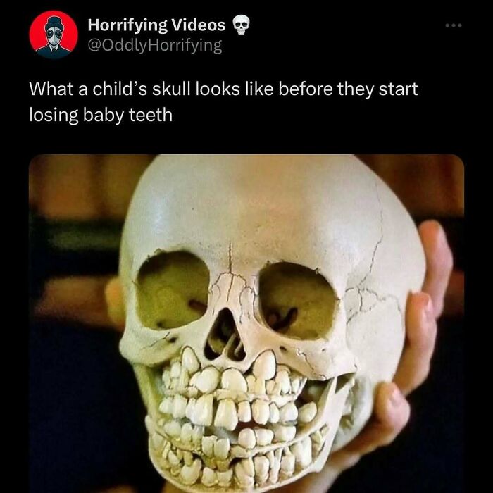 A child's skull before losing baby teeth, unnerving image held in hand.