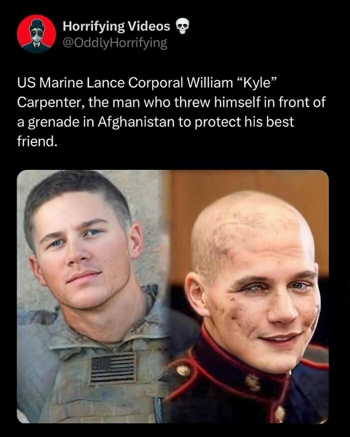 US Marine with facial injuries, showcasing an unnerving transformation, symbolizing bravery and sacrifice.