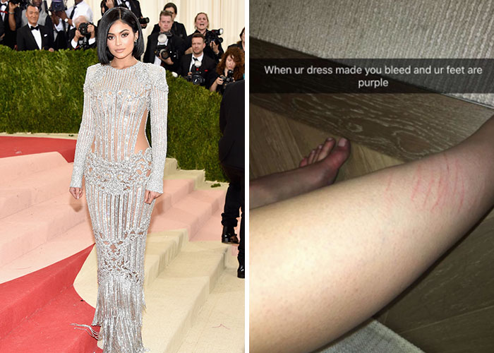 Celeb in silver gown on red carpet; scratched leg with text, highlighting behind-the-scenes red carpet facts.