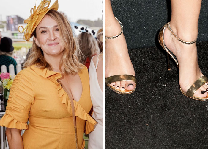 Woman in a yellow dress and a pair of gold high heels, illustrating unglamorous red carpet realities.