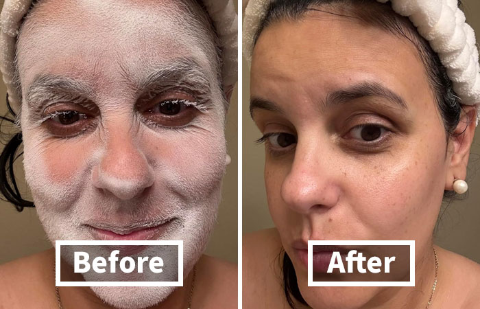 Before and after skincare treatment showing improved skin texture, addressing mortifying body problems like dryness.