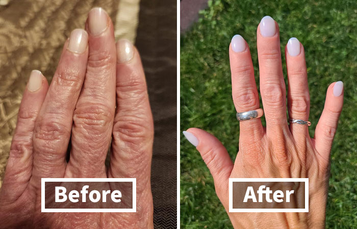 "Transformation of hands before and after treatment, highlighting common body problems."