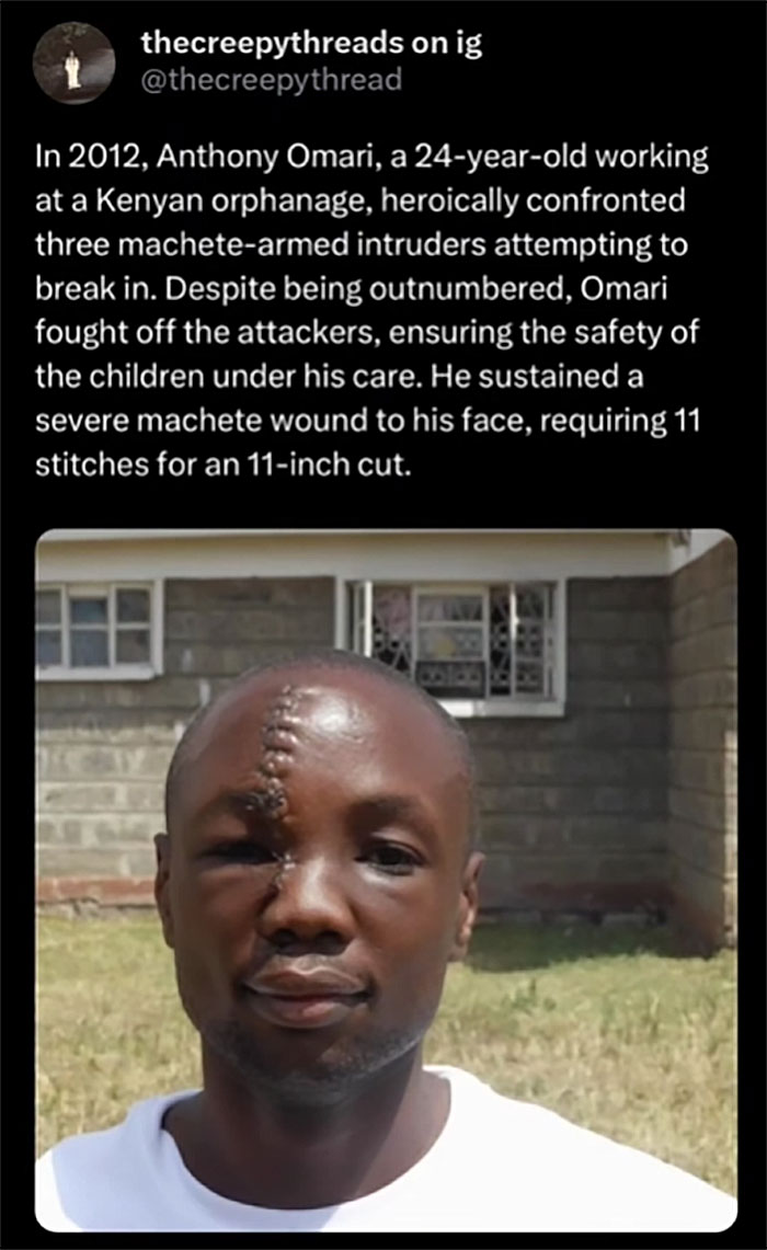 Man with a large stitched machete wound on his face, a shocking and spooky fact about our world’s dangers.