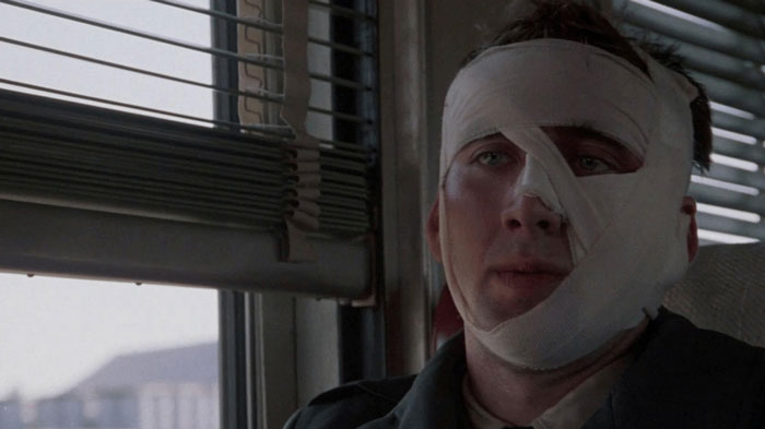 Actor with face bandaged in a dramatic scene illustrating actors going above and beyond for difficult roles.