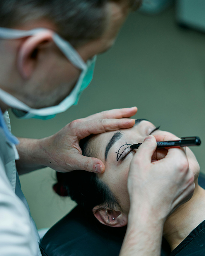 Surgeon marking eyelid for cosmetic surgery, focusing on precise lines. Surgeon marking eyelid for cosmetic surgery, focusing on precise lines.