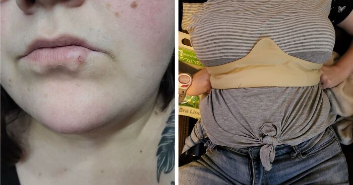 24 Mortifying Body Problems Nobody Wants To Talk About But Everyone Has