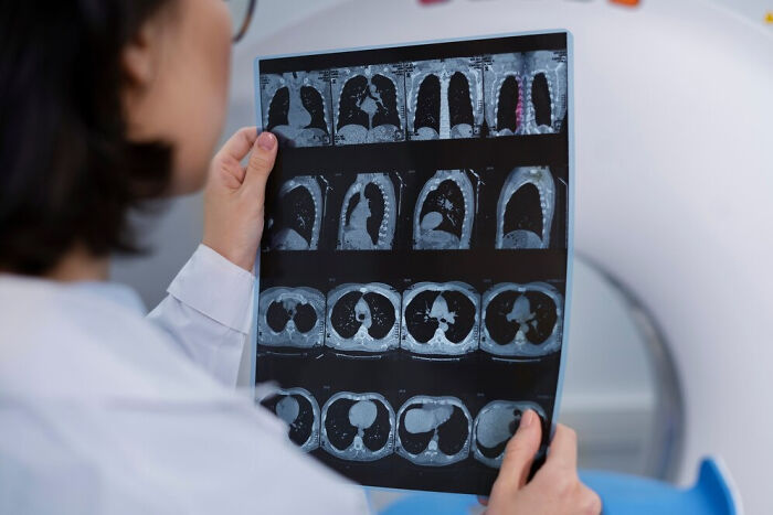 Doctor examining lung X-rays, focusing on questions about medical insights and diagnostics.