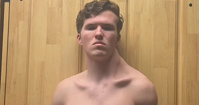 Viral Teen Only Trains One Side Of His Body, Claims It Helps Him Avoid Female Attention