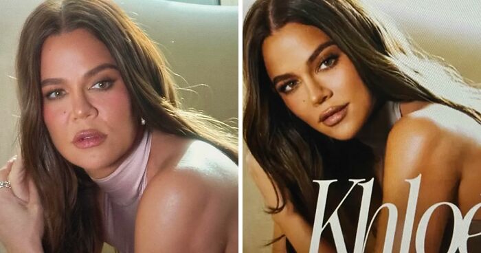 “They All Want To Look Like Kim”: Khloe Kardashian Faces Backlash Over “Botched” Nose Photo Fail