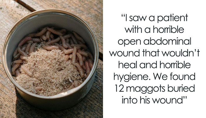 30 Doctors Share The Weirdest And Most Disgusting Things Found In People’s Bodies