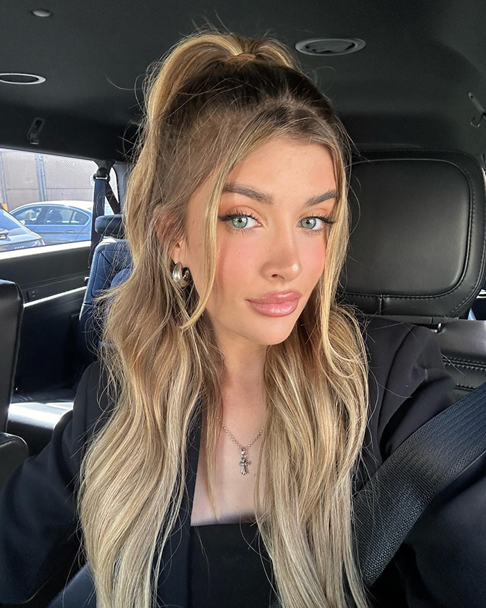 Young woman with long blonde hair in a car, discussing cosmetic surgeries.