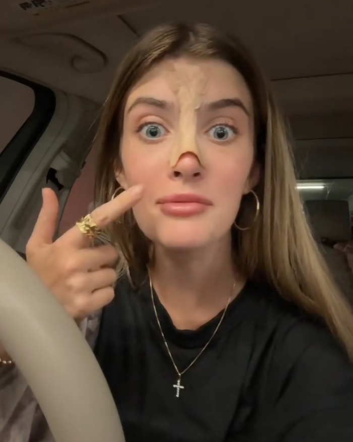 Young woman pointing at her nose in a car, highlighting cosmetic surgery changes.