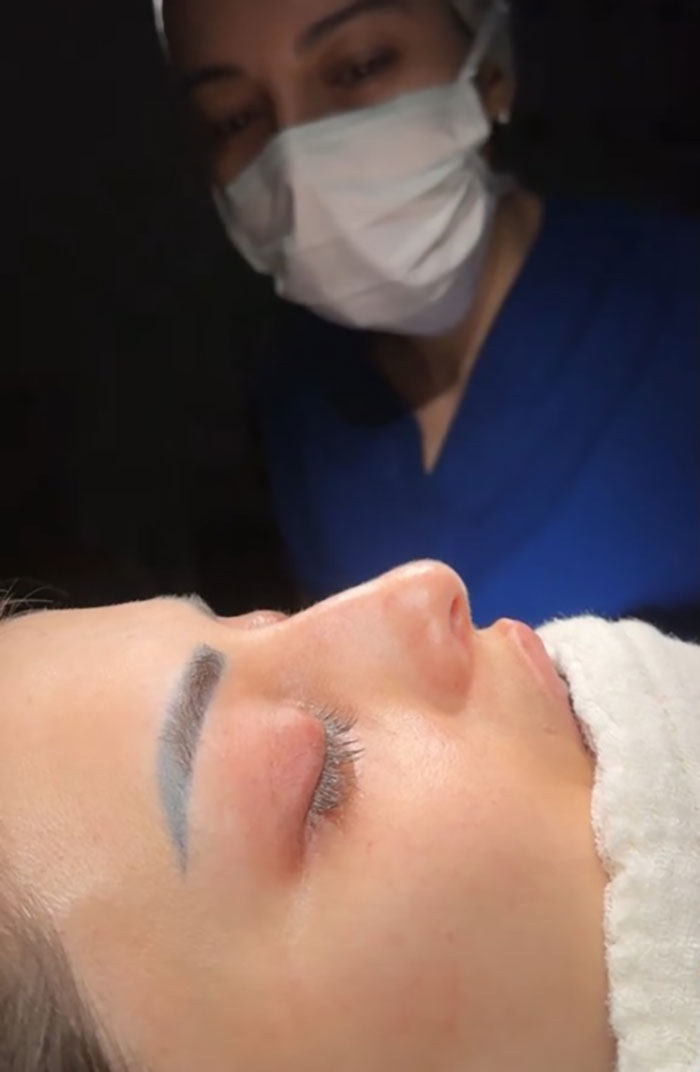 Patient undergoing nose job procedure, with surgeon in a blue uniform and mask nearby, highlighting cosmetic surgery risks.