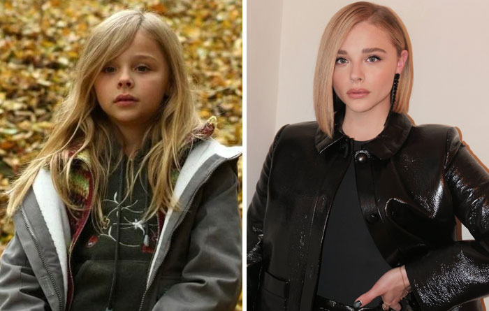 Side-by-side then and now photos of a famous celebrity showcasing changes over time for famous celebrities keyword.