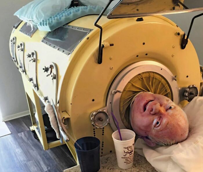 Man in an iron lung with a yellow exterior, part of fascinating stories from around the world.