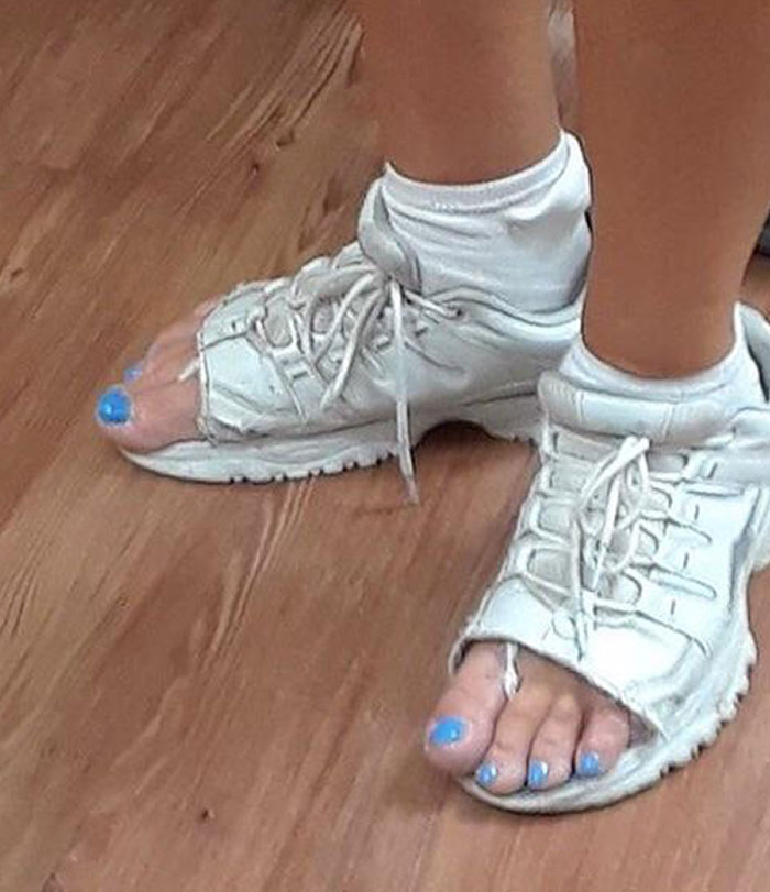 Failed repair: sneakers turned into sandals with visible toes and blue nail polish.