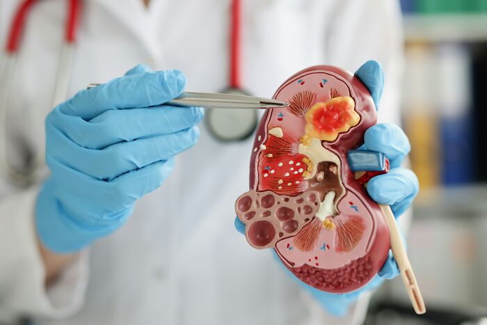 Doctor pointing at kidney model, showcasing medical details with absolute confidence.