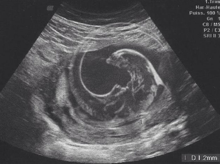 Ultrasound scan resembling a velociraptor, showcasing the creative humor of hilarious men.