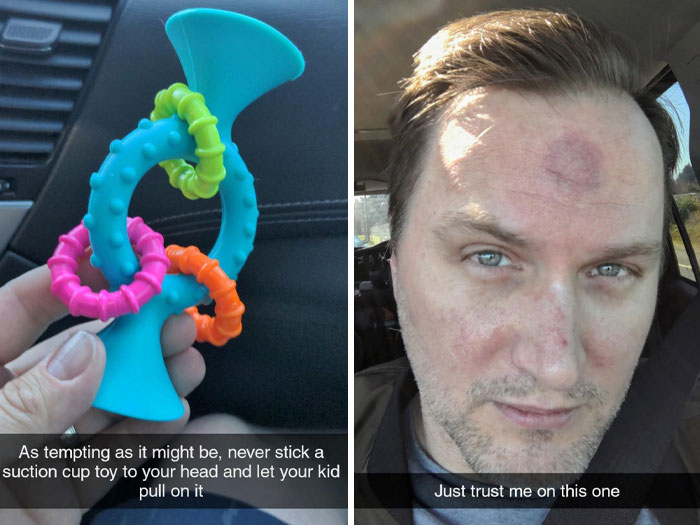 Man shows a suction toy and a mark on his forehead, illustrating a worse day humorously.