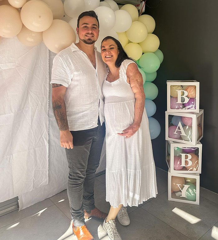 Miracle burns survivor in a white dress, smiling with partner during a celebratory event with balloons and baby blocks.