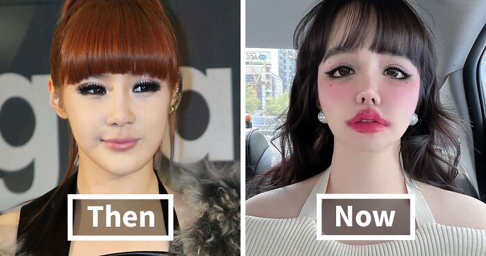 K-Pop Star Stuns Fans With Bizarre Transformation Amid Cosmetic Surgery Rumors