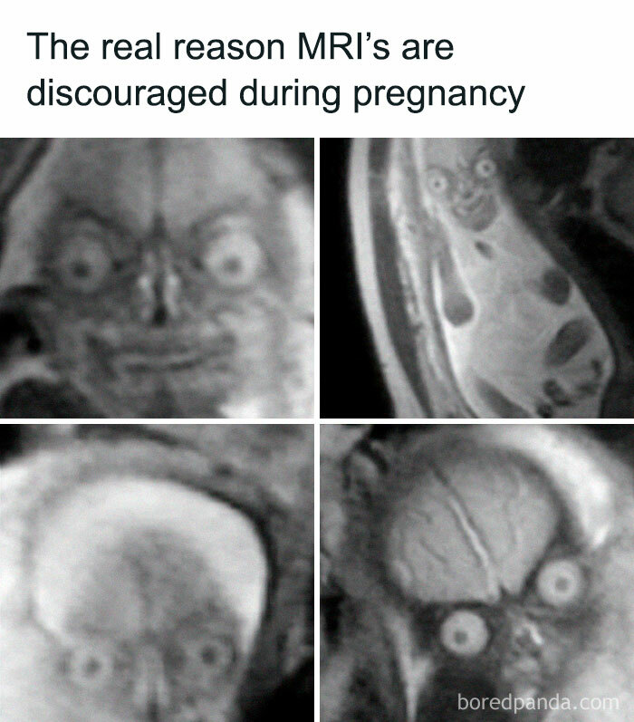 Four humorous MRI images with exaggerated features, highlighting funny aspects of medical school challenges.