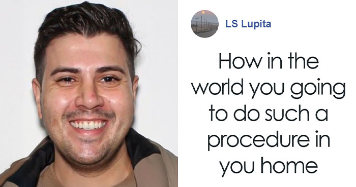 “So Much Stupidity”: Woman Gets Surgeon From TikTok To Remove BBL At Home, Loses Her Life