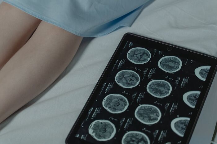 Tablet displaying brain scans on a bed next to a patient's legs, illustrating doctors' disturbing discoveries.