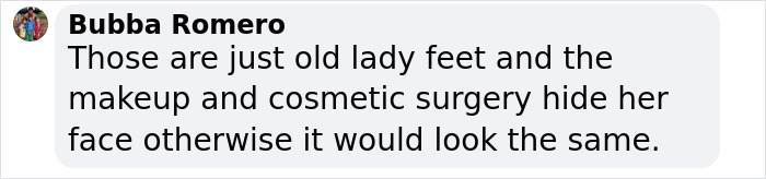 Comment discussing Ozempic feet and cosmetic surgery effects.