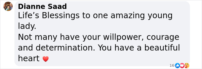 Message praising a burns survivor's courage and beautiful heart after sharing wedding moments.