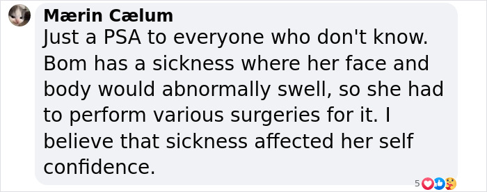 Comment about K-Pop star's transformation and surgeries amid plastic surgery rumors.