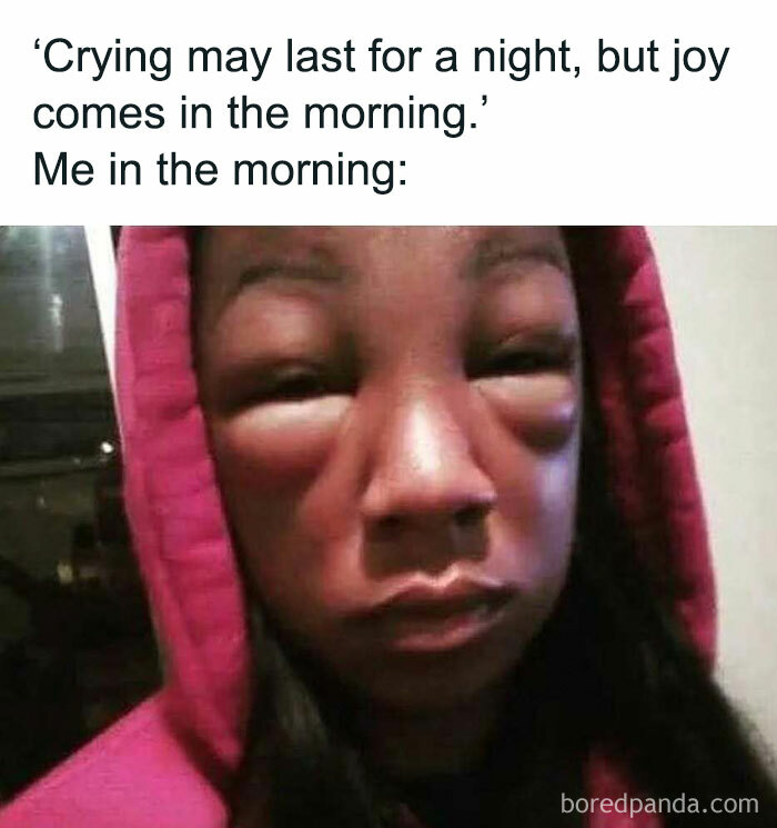 Person with a swollen face and red hoodie, humorously illustrating a relatable morning struggle meme.