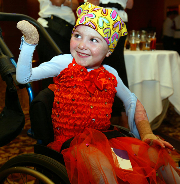 Miracle burns survivor in vibrant dress and colorful headscarf, smiling and sitting in a wheelchair during a festive event.