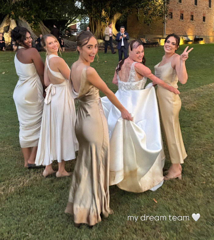 Wedding weekend with miracle burns survivor and bridesmaids outdoors, smiling and posing in elegant dresses.