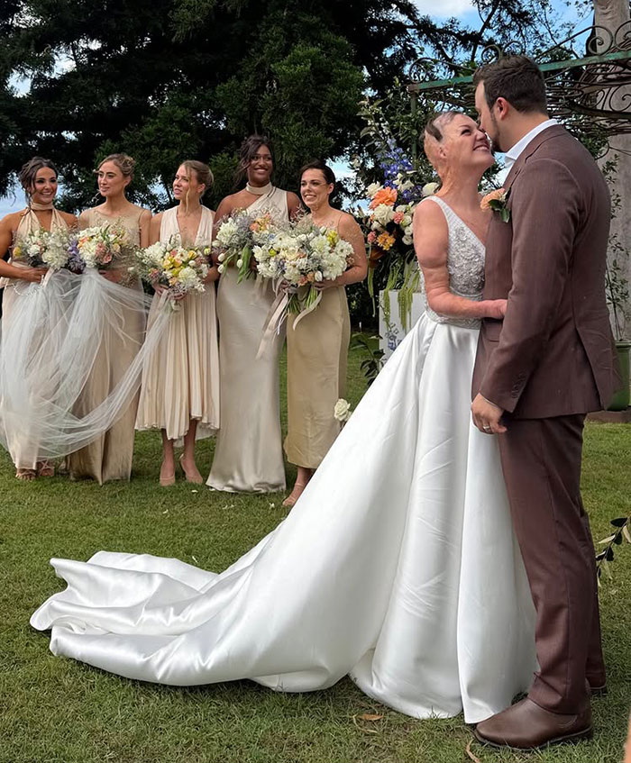 Miracle burns survivor at wedding, wearing a white gown, smiling with partner, surrounded by bridesmaids with bouquets.