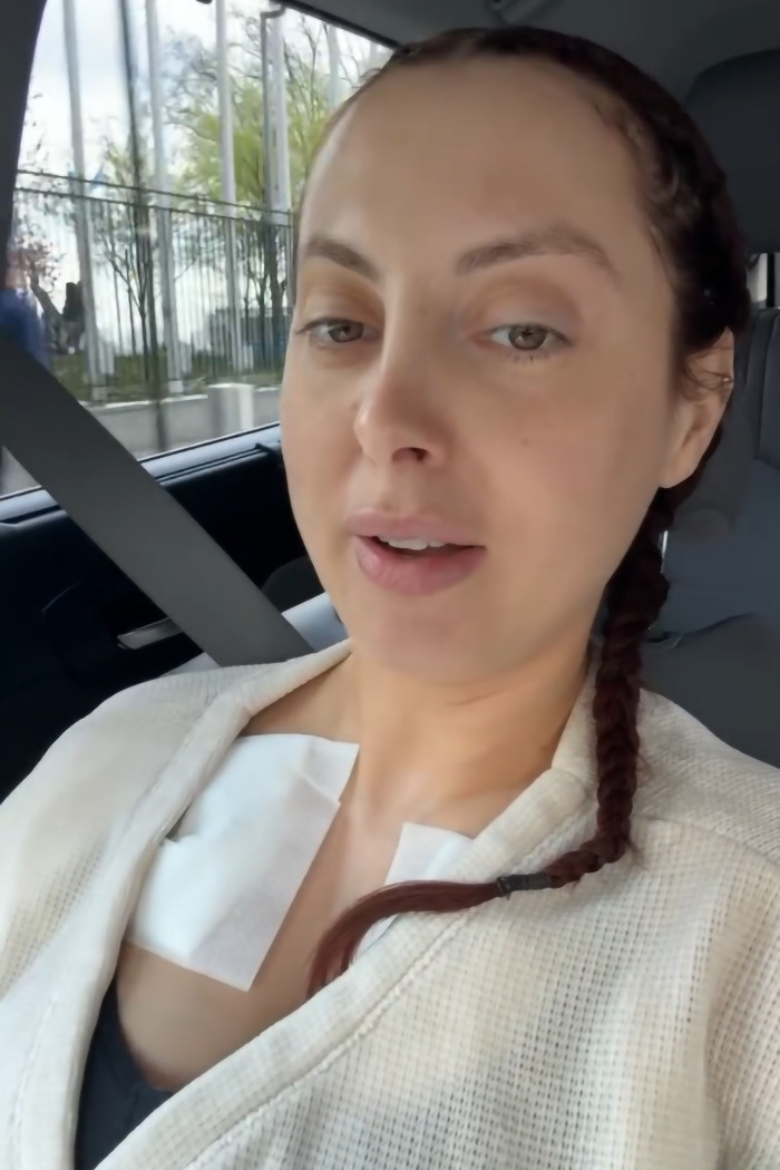 Woman with braided hair in a car, wearing a white top post-plastic surgery on her chest.
