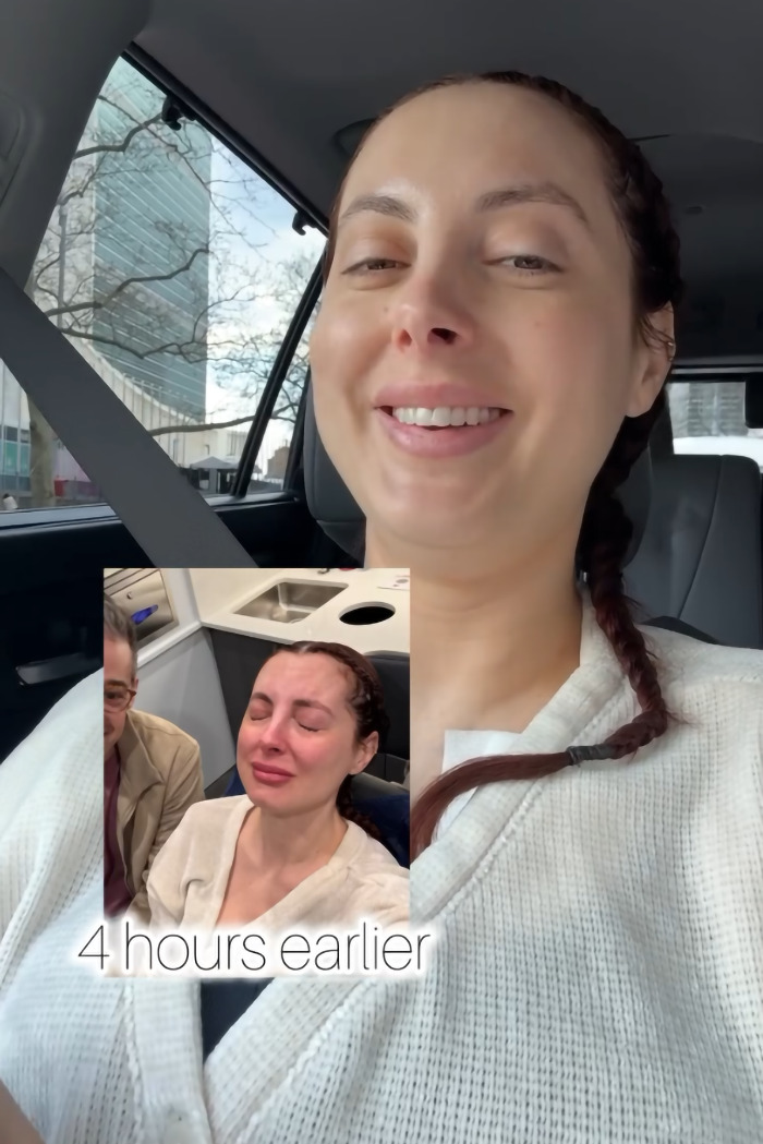 Woman after plastic surgery, smiling in a car with inset past image showing emotion post-procedure.