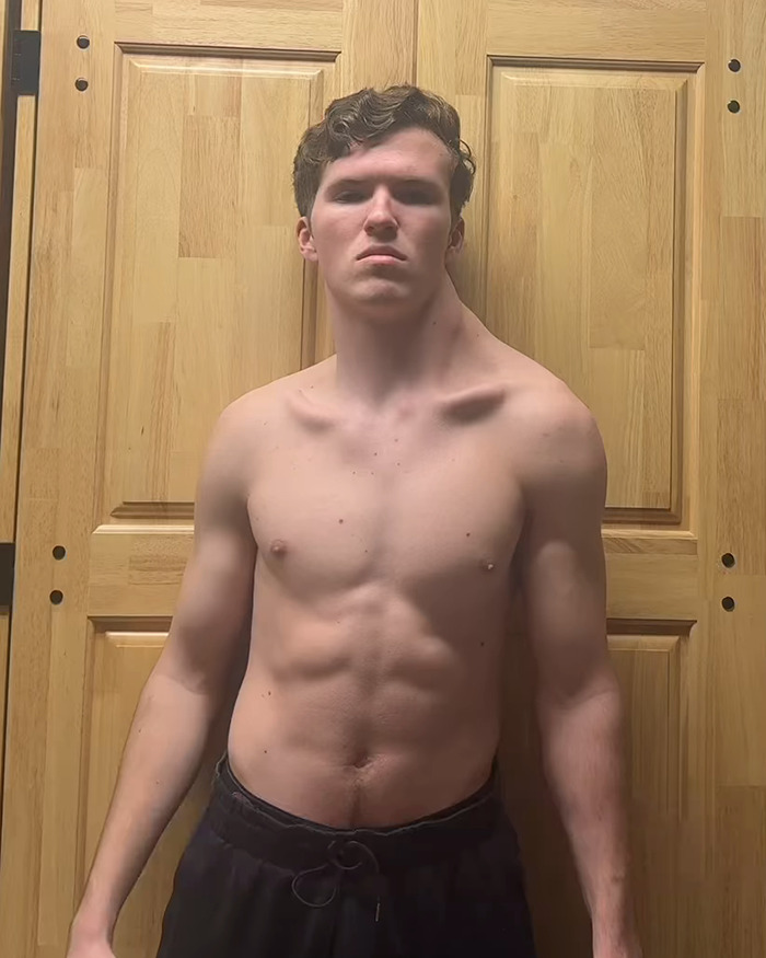 19-year-old known as "The Crooked Man" shows off asymmetrical physique, focusing on one-sided workouts.