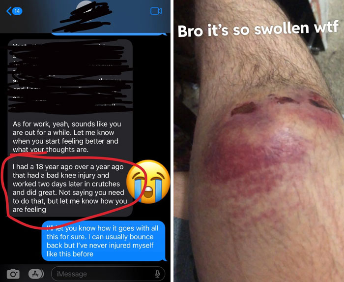 Text conversation with a boss about work despite a swollen knee injury, highlighting an infuriating superior.