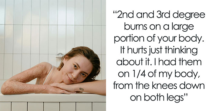 29 Pains You’ll Never Grasp The Extent Of Until You’ve Experienced Them
